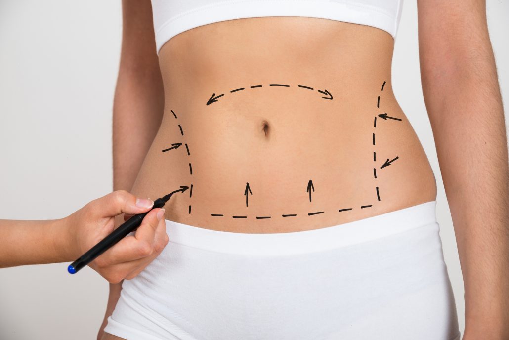 Lubbock plastic surgery