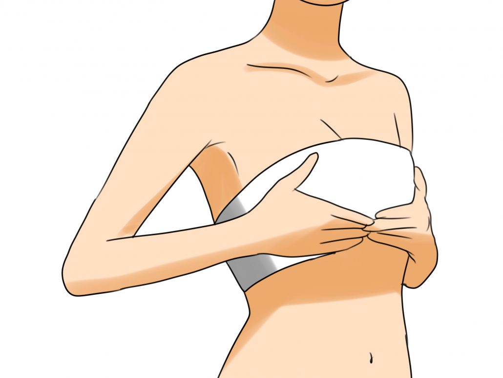 breast augmentation