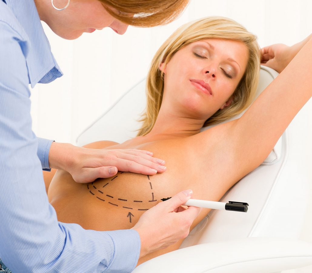 breast augmentation